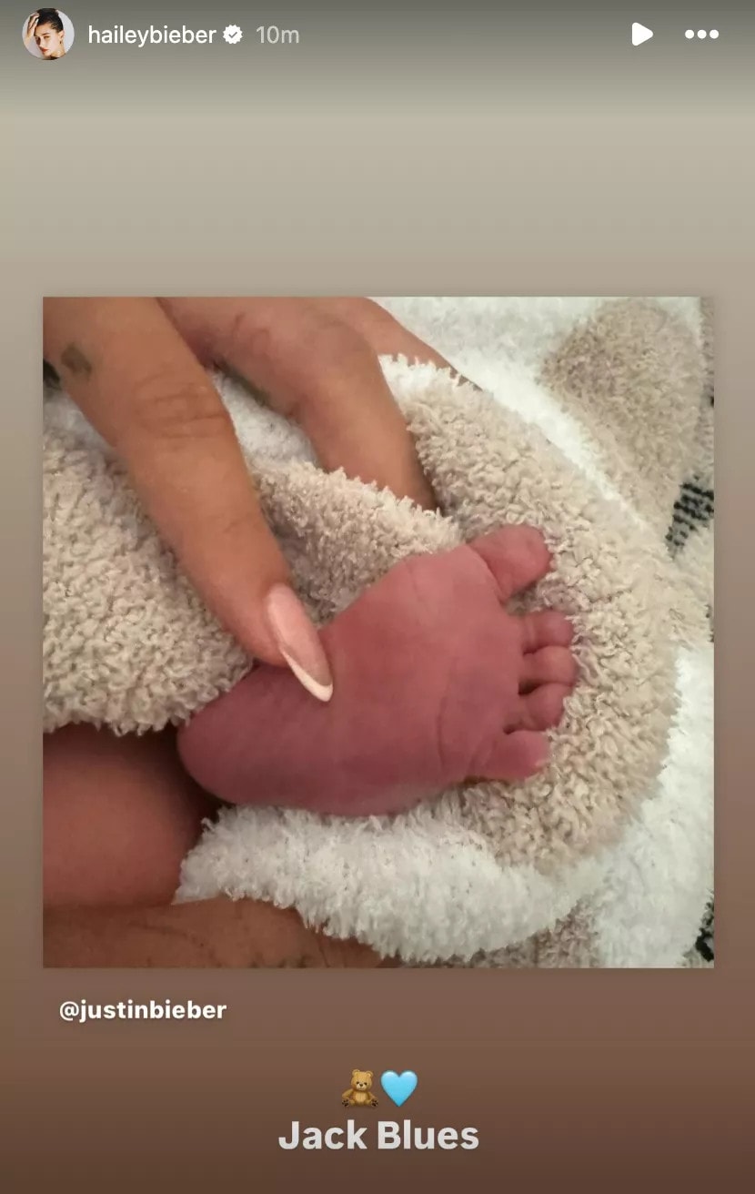 Justin and Hailey Bieber